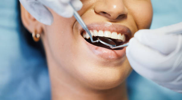 Emergency Treatment for Gum Disease