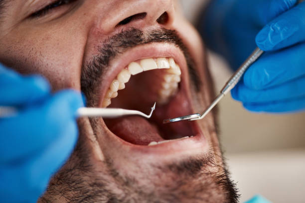 Best Walk-In Emergency Dentist in Cologne, MN